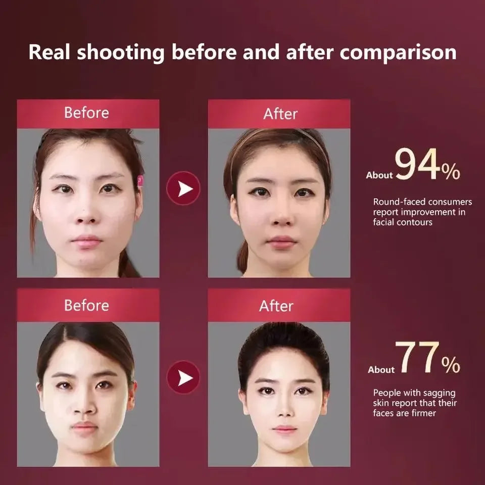 LED Photon Therapy Facial Slimming Vibration Massager Facial Lifting Device Facial Double Chin V Face Vibration Massager